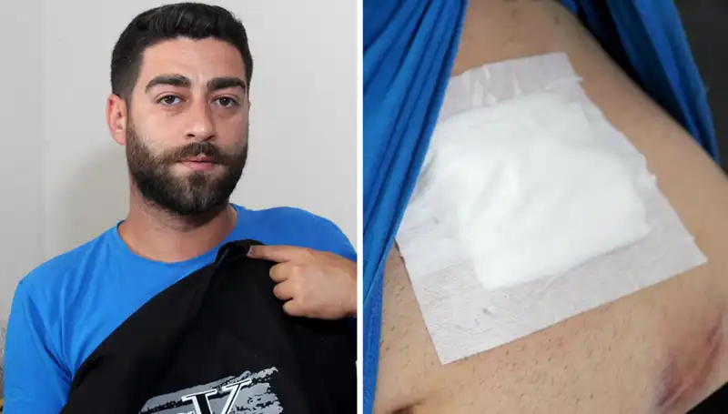 Karnında Ağrı Hissetti, Röntgen Sonucu Hayatını Değiştirdi!