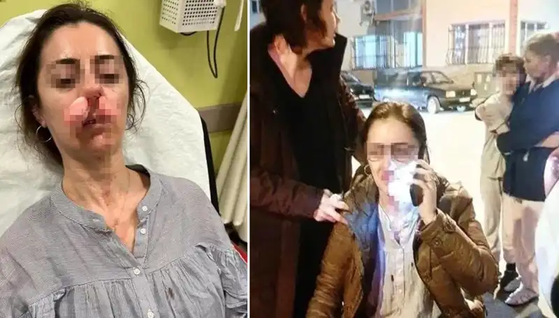 Otomobil Kapısı Silah Olarak Kullanıldı: Eşinin Sevgilisi Zannedilince Saldırıya Uğradı