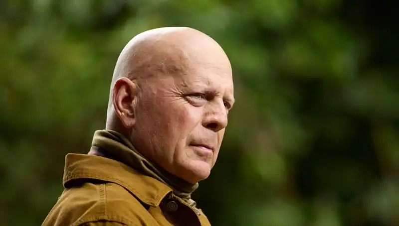 Bruce Willis’in Tıbbi Mücadelesi: Afazi Hastalığının Belirtileri ve Nedenleri