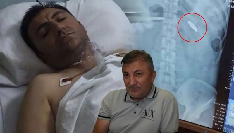 15 Temmuz'un Gölgeleri: Vücudunda Kurşunla Taşıdığı 9 Yıllık Acı Miras